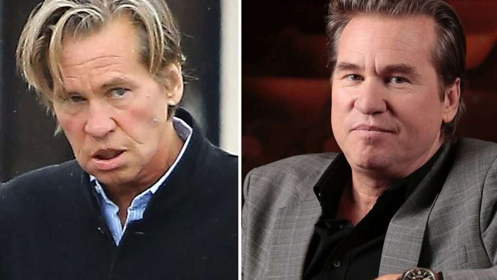 Val Kilmer Sjuk